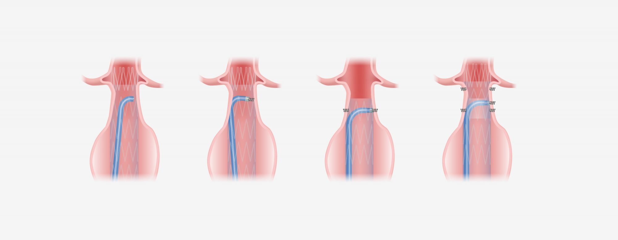 portfolio-graphics-Oct20-v1_aptus